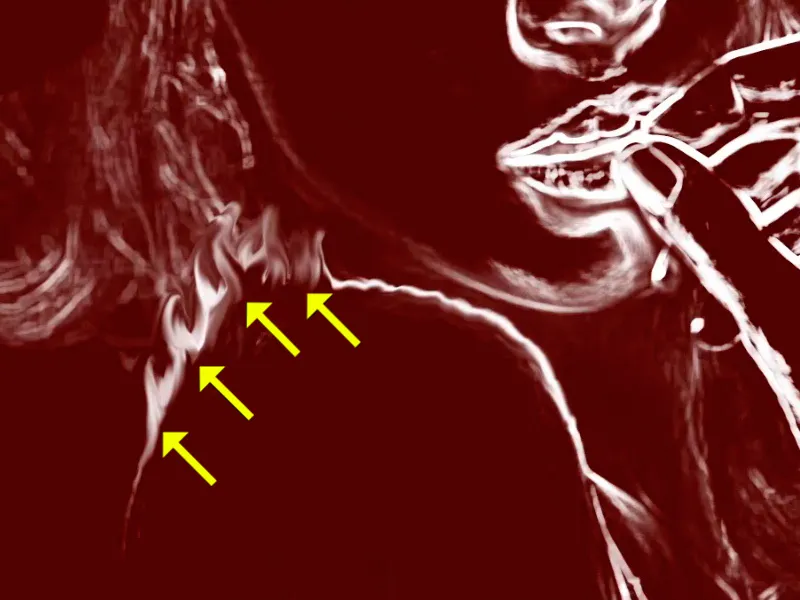 Photoshop-Composing - Feuer und Eis - Teil 03: Feuer ins Bild wischen